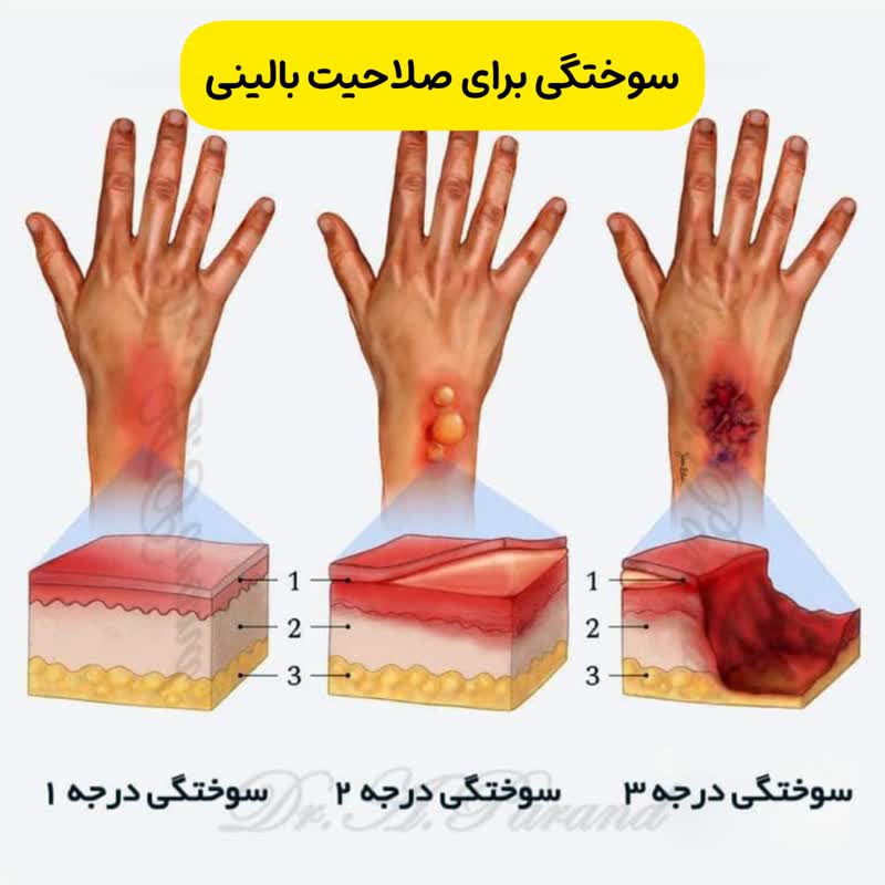 سوالات احتمالی آزمون صلاحیت بالینی ، سوالات شایعه شده صلاحیت بالینی ، سوالات صلاحیت بالینی مرداد 1403 ، آزمون صلاحیت بالینی ، دکتر علی ، دکتر ژیان ، دکترهای خوب ، دانلود سوالات صلاحیت ، خلاصه طلایی صلاحیت بالینی ، 