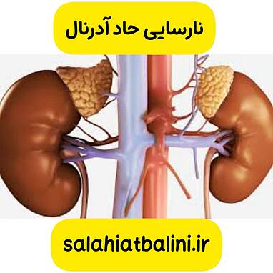 مدیریت بیمار با نارسایی حاد آدرنال در اورژانس از سری سوالات احتمالی آزمون صلاحیت بالینی