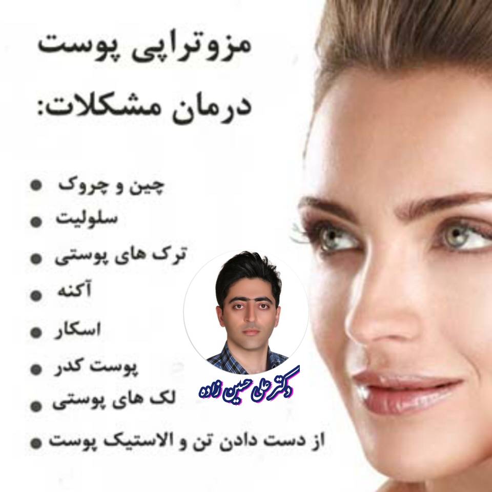 موارد کاربرد مزوتراپی و پی آر پی در پرند