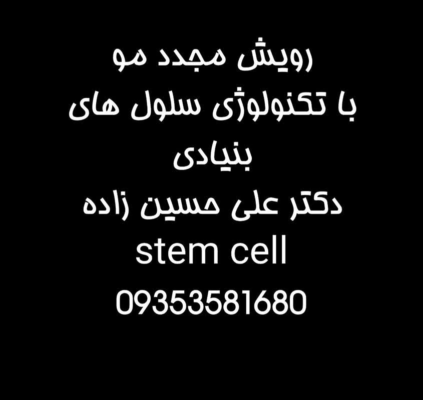 رویش مجدد موی در پرند رباط کریم شهریار اسلامشهر غرب تهران